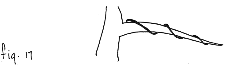 Fig. 17: Alambrado, vueltas