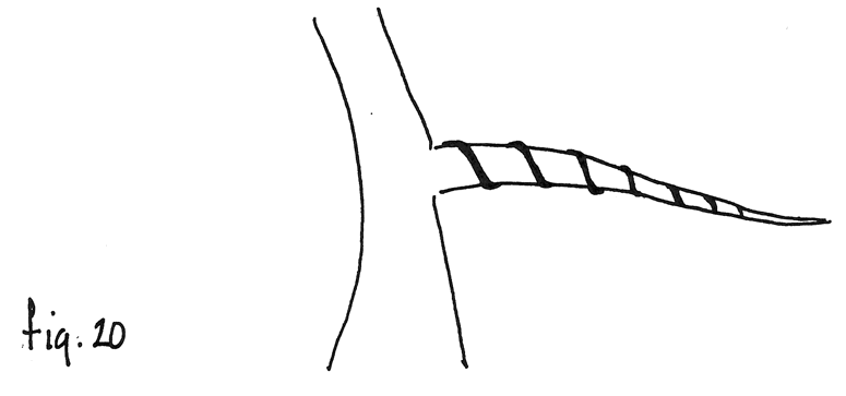 Fig. 20: Alambre demasiado apretado