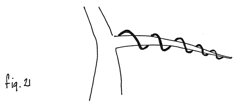 Fig. 21: Alambrado demasiado suelto