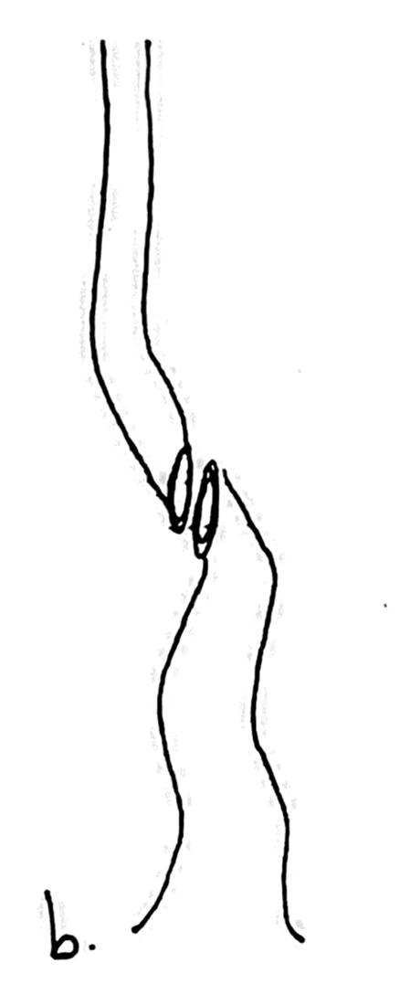 Fig. 31b: Después del primer corte